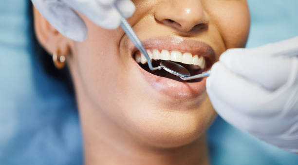 Best Emergency Dental Services for Seniors in North Highlands, CA